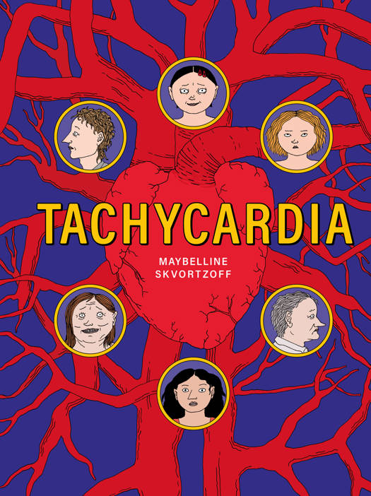 Tachycardia
