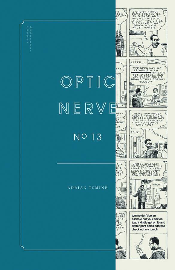 OPTIC NERVE 13