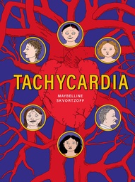 Tachycardia