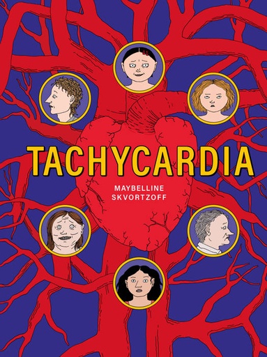 Tachycardia